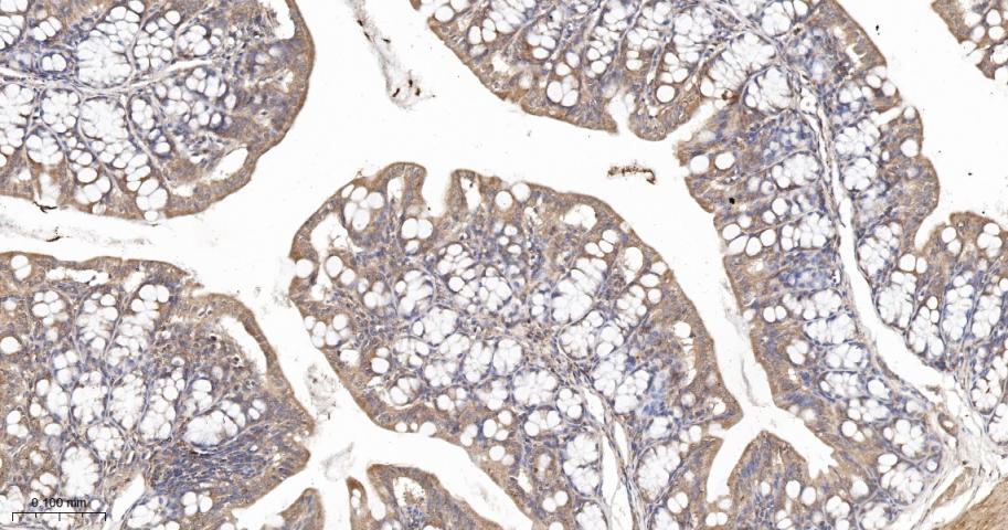 KB抑制蛋白激酶γ重组兔单抗
