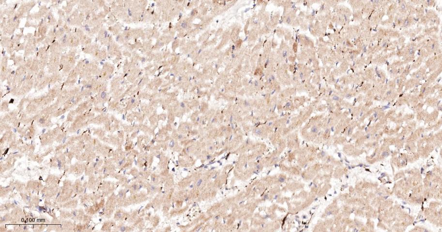 G蛋白偶联受体6重组兔单抗