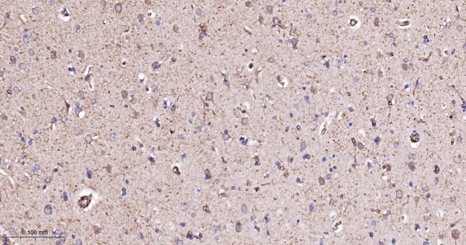 毒蕈碱型乙酰胆碱受体重组兔单抗