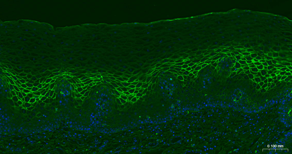 多配体蛋白聚糖1（CD138）重组兔单抗