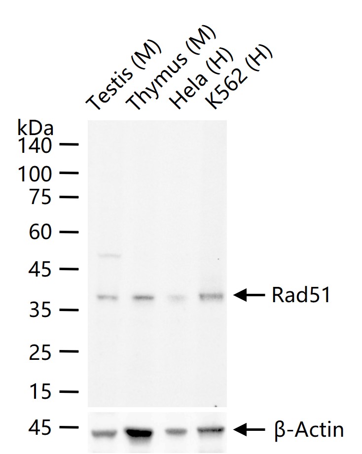 Rad51重组兔单抗