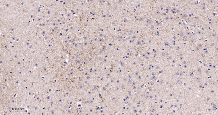 NSMase2 Rabbit pAb (一抗) - IHC-P,IHC-F,IF,ELISA | Bioss