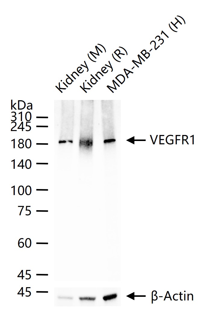 VEGFR1 Rabbit pAb (一抗) - WB,IHC-P,IHC-F,IF | Bioss