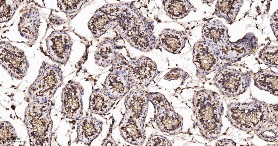 硫氧还蛋白重组兔单抗-bsm-63003R