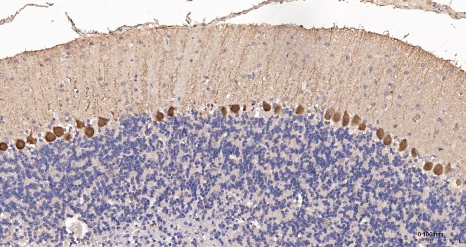 钙结合蛋白D28K抗体-bs-10177R