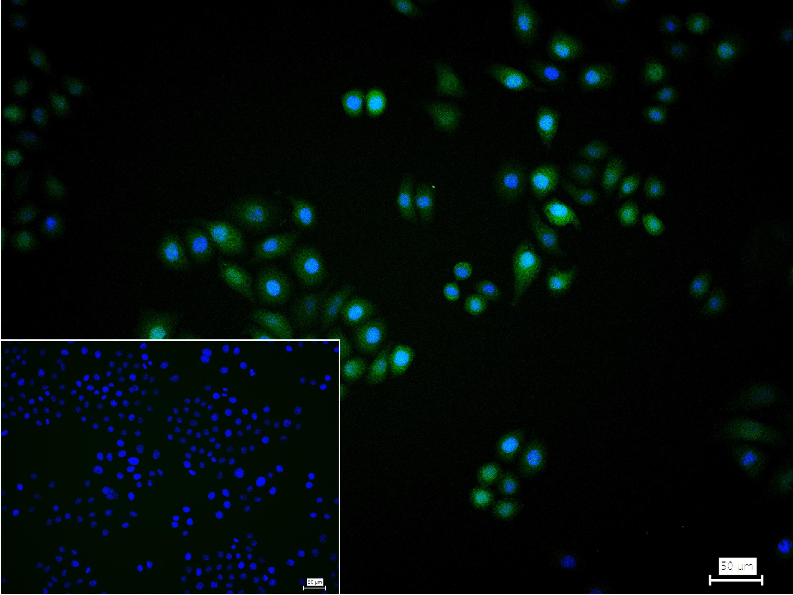 eIF4E结合蛋白重组兔单抗