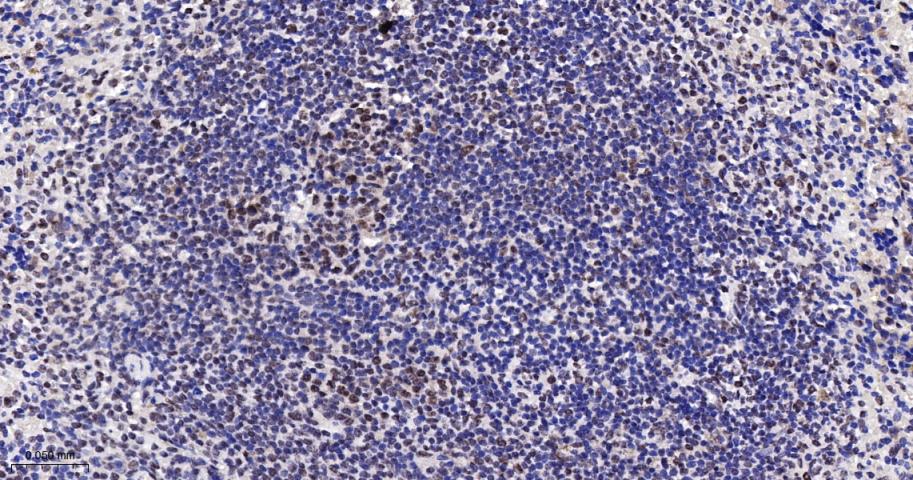 原癌基因Bcl-6抗体-bs-2734R