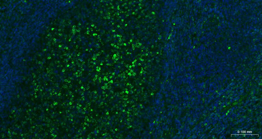 CD79A重组兔单克隆抗体