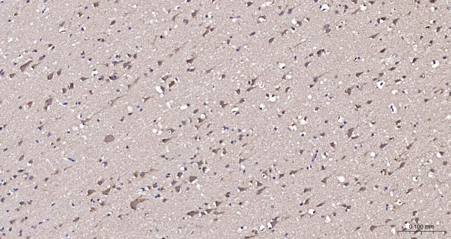 钙结合蛋白D28K抗体-bs-10177R