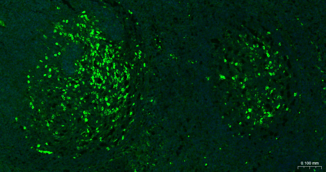 CD38单克隆抗体-bsm-34151M
