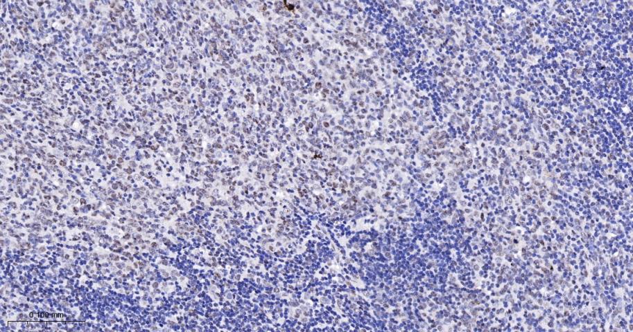 原癌基因Bcl-6抗体-bs-2734R