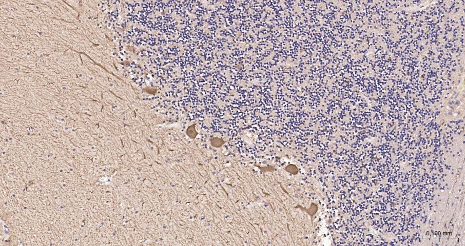 钙结合蛋白D28K抗体-bs-10177R