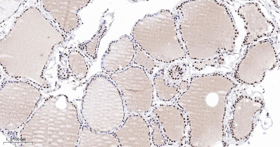 错配修复蛋白2重组兔单抗