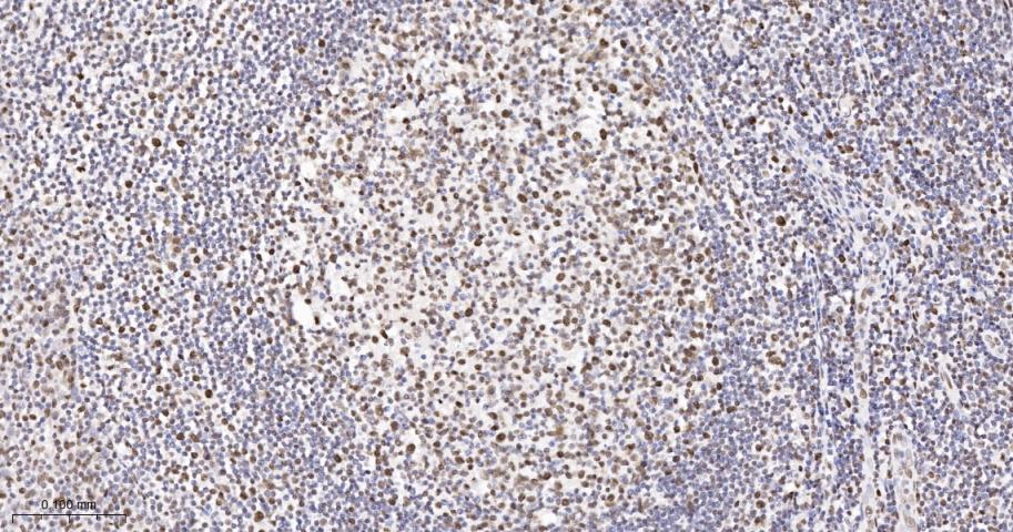 错配修复蛋白2重组兔单抗