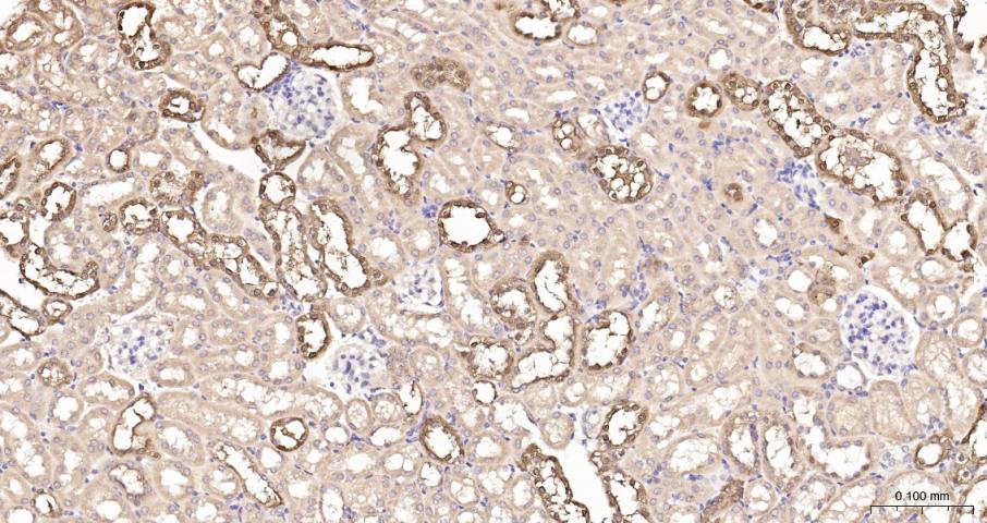 钙结合蛋白D28K抗体-bs-10177R