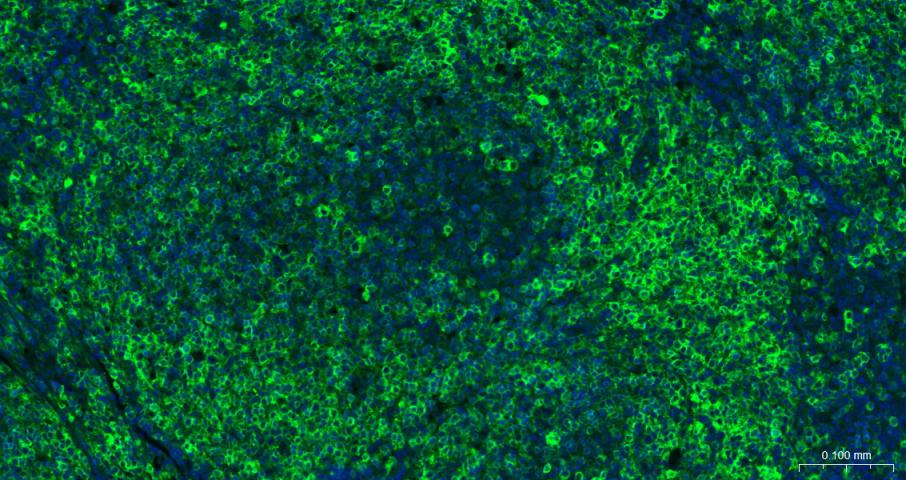 CD79A重组兔单克隆抗体