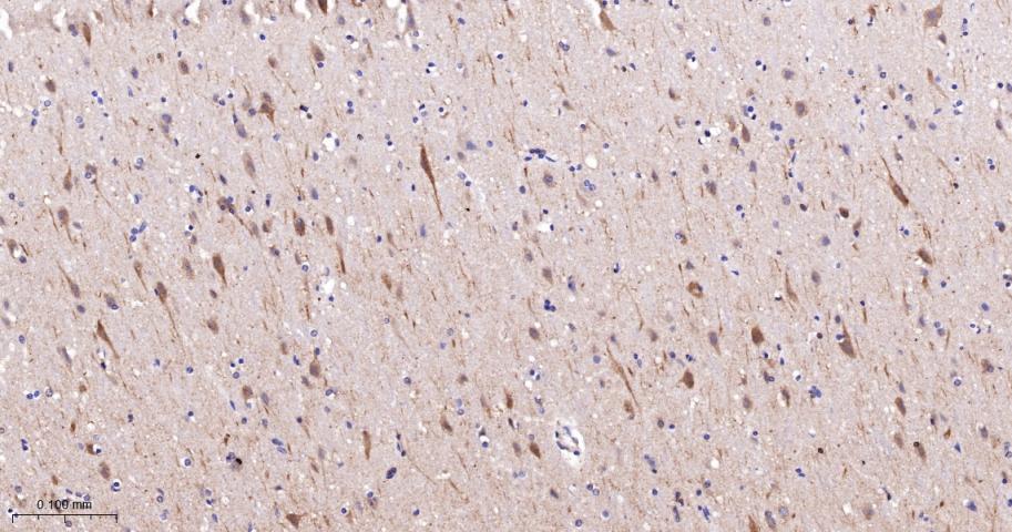 毒蕈碱型乙酰胆碱受体重组兔单抗