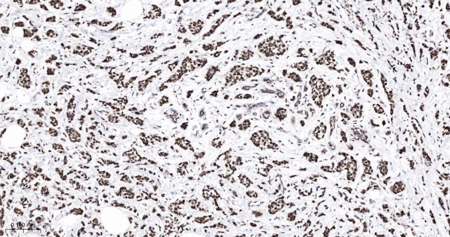 错配修复蛋白2重组兔单抗