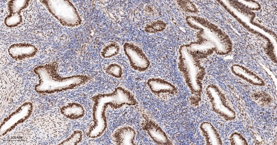 错配修复蛋白2重组兔单抗