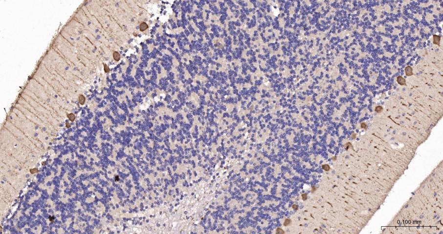 钙结合蛋白D28K抗体-bs-10177R