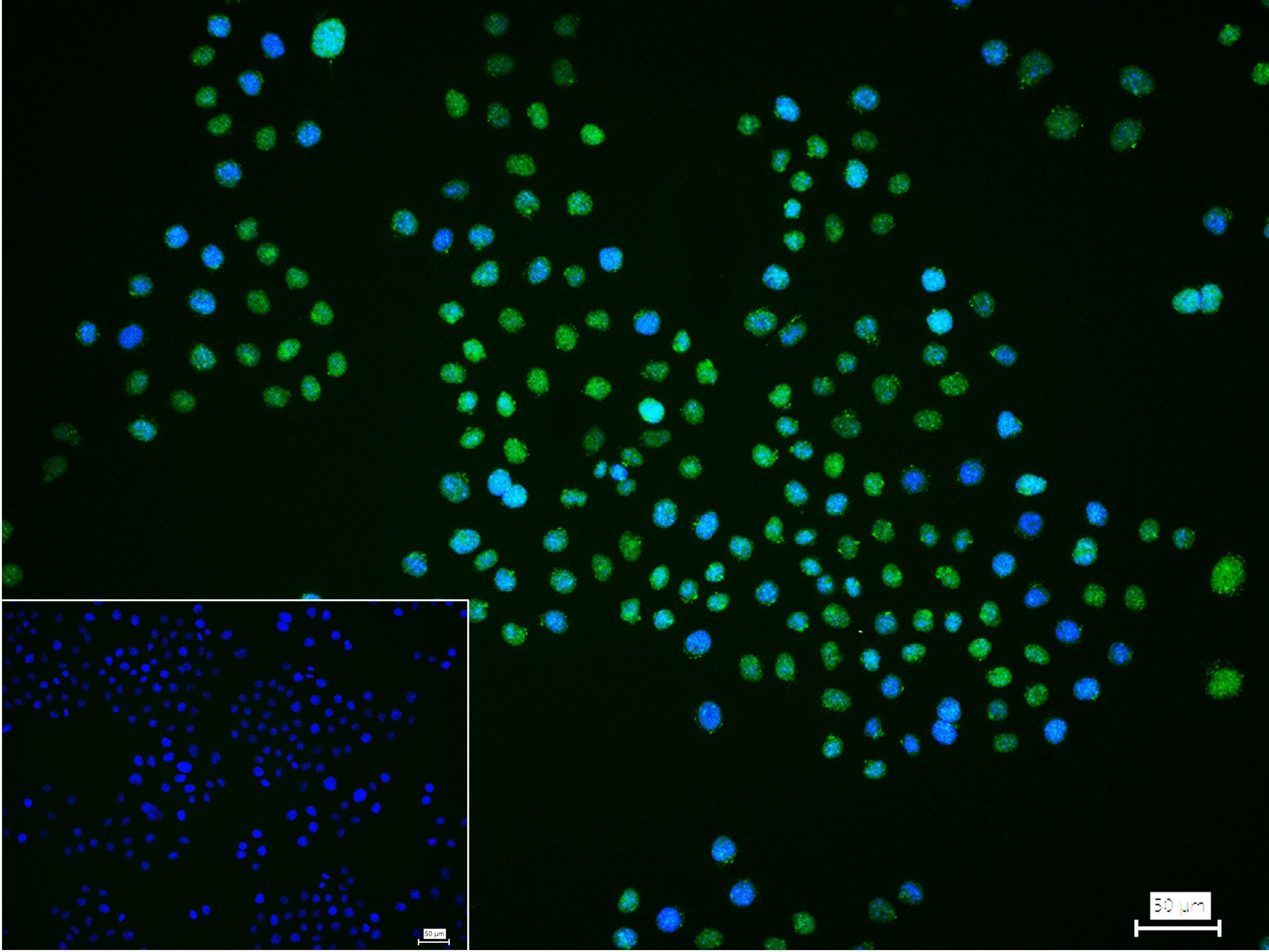 异染色质蛋白1-α重组兔单抗-bsm-61202R
