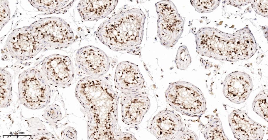 错配修复蛋白2重组兔单抗