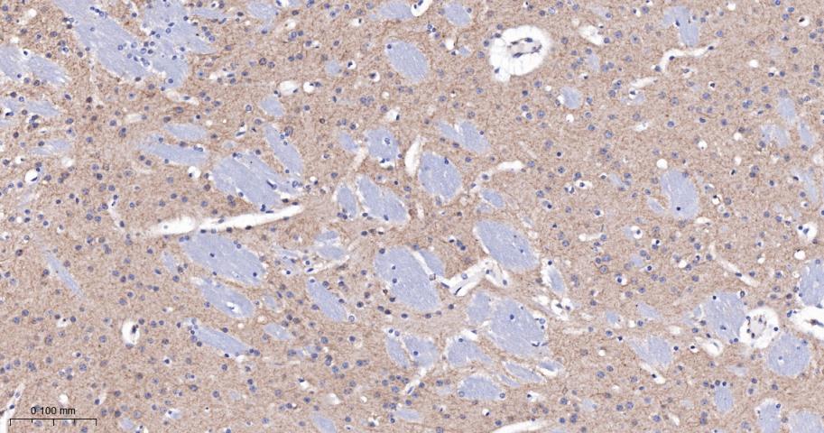 毒蕈碱型乙酰胆碱受体重组兔单抗