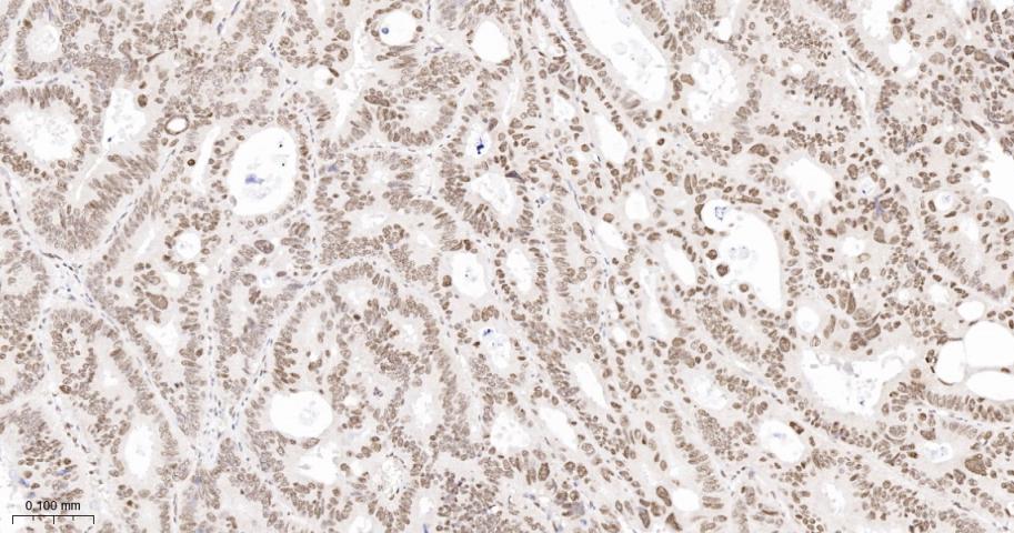 错配修复蛋白2重组兔单抗