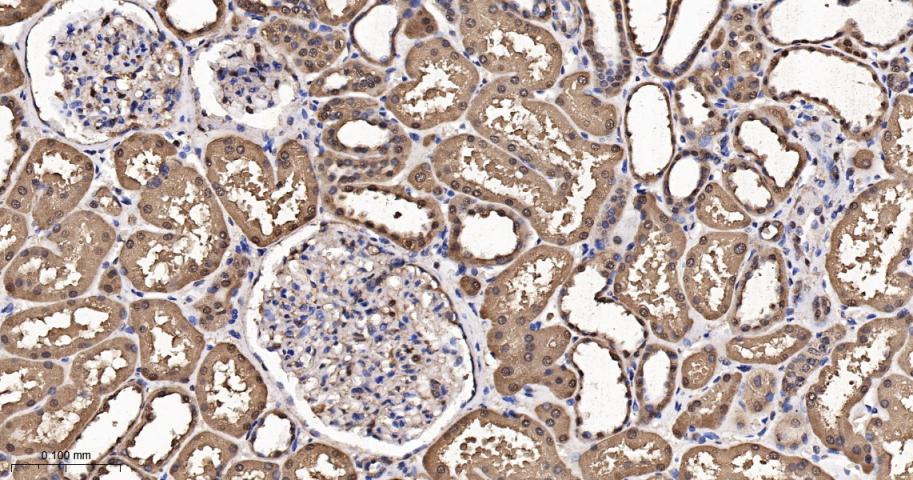 硫氧还蛋白重组兔单抗-bsm-63003R