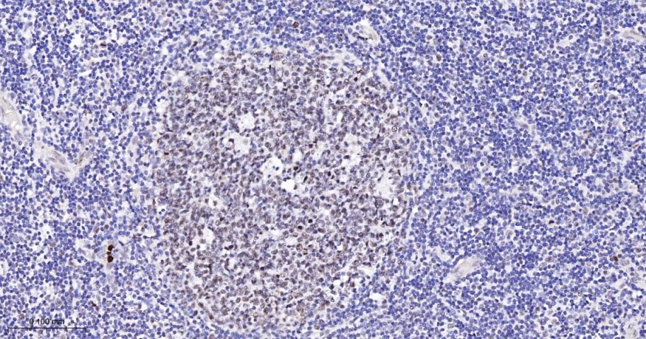 原癌基因Bcl-6抗体-bs-2734R