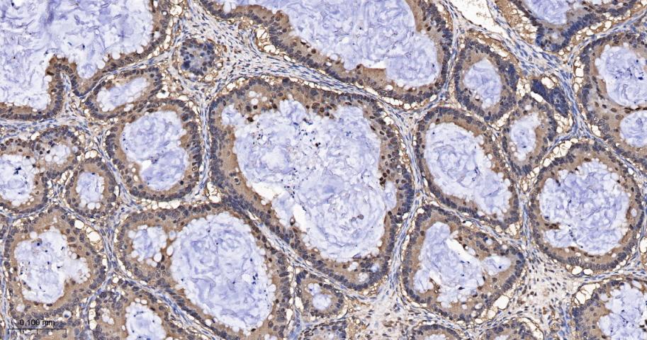 硫氧还蛋白重组兔单抗-bsm-63003R