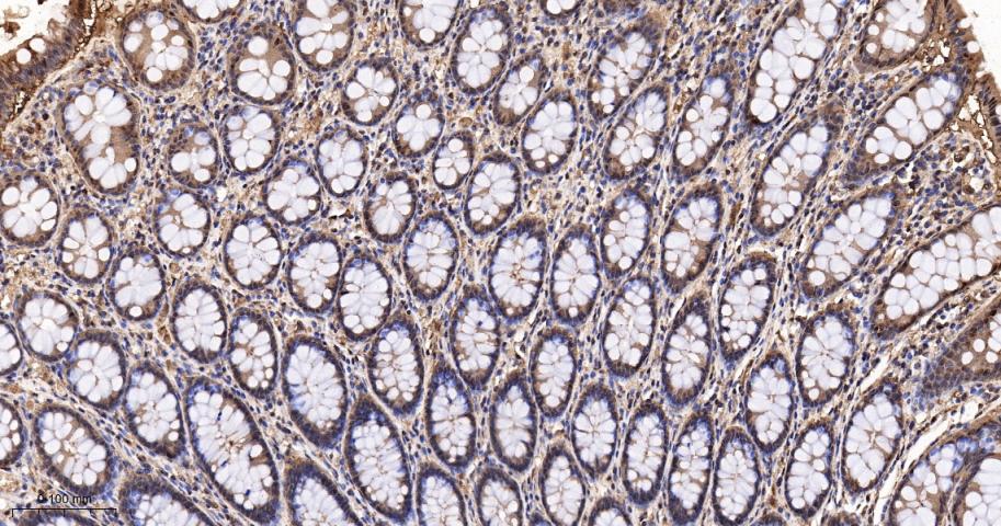 硫氧还蛋白重组兔单抗-bsm-63003R