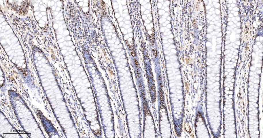 错配修复蛋白2重组兔单抗