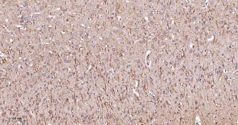 毒蕈碱型乙酰胆碱受体重组兔单抗
