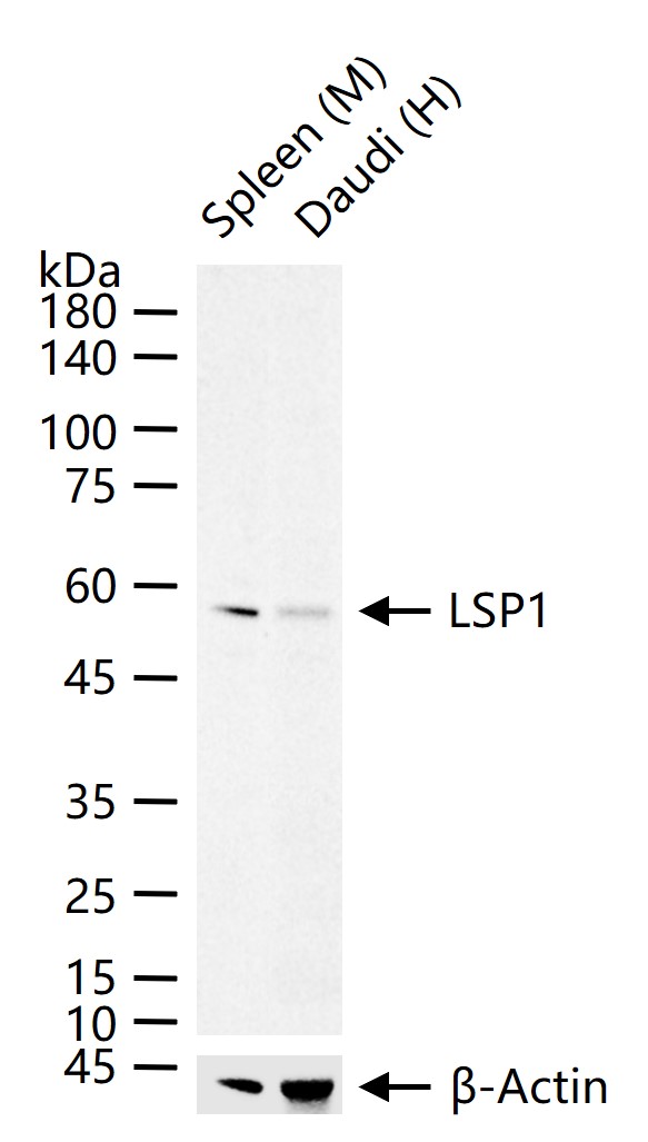 白细胞F肌动蛋白结合蛋白重组兔单抗
