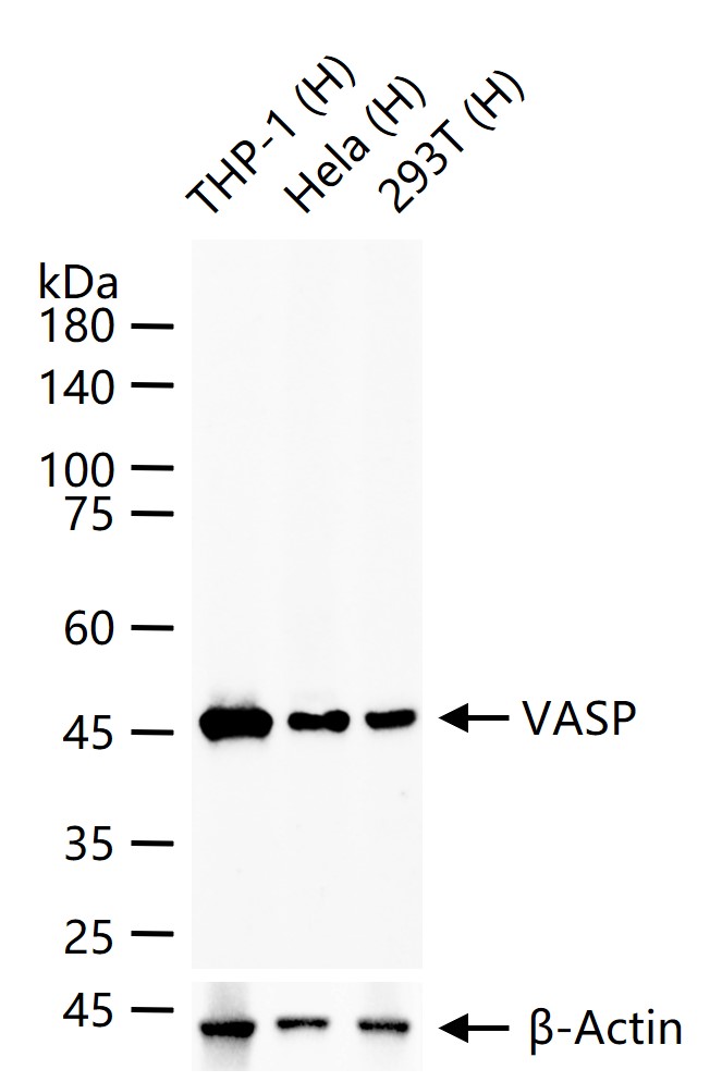 VASP Recombinant Rabbit mAb (一抗) - WB,IP | Bioss