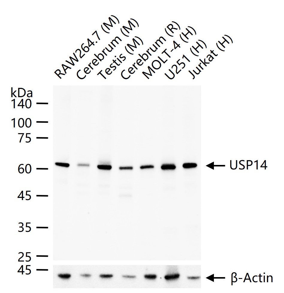 双特异性磷酸酶重组兔单抗14重组兔单抗