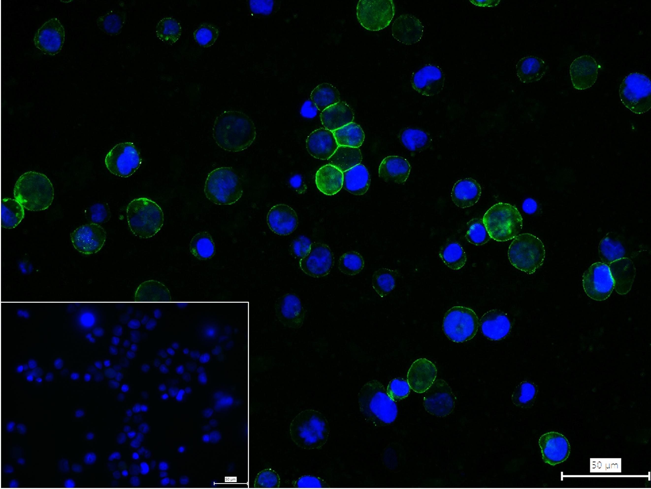 血小板内皮细胞黏附分子-1重组兔单抗