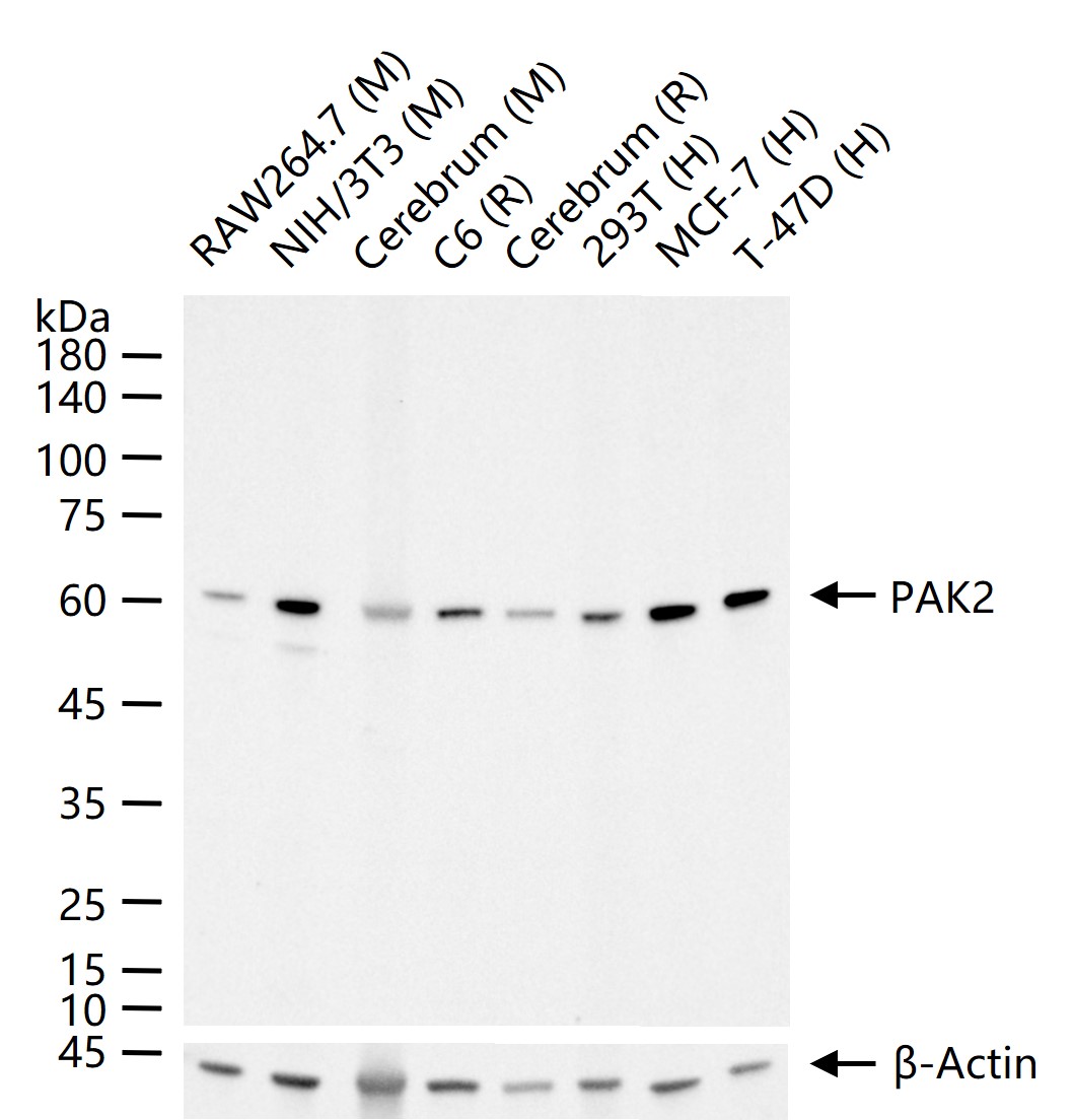 p21激活激酶2重组兔单抗