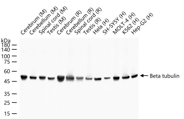 Beta tubulin Mouse mAb, Loading Control (一抗) - WB,IHC-P,IHC-F,IF,ICC/IF | Bioss