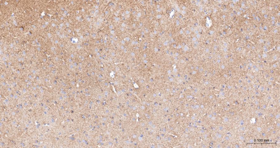 血管内皮生长因子受体1抗体-bs-0170R