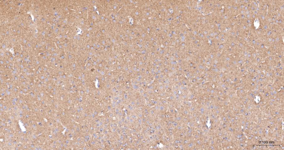 血管内皮生长因子受体1抗体-bs-0170R