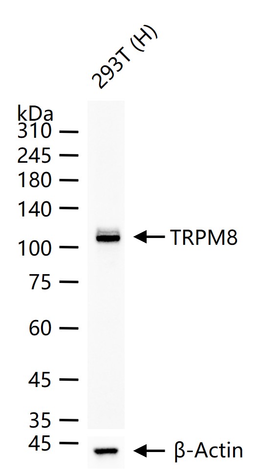 “冷”蛋白TRPM8重组兔单抗