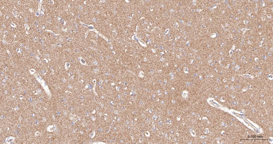 血管内皮生长因子受体1抗体-bs-0170R