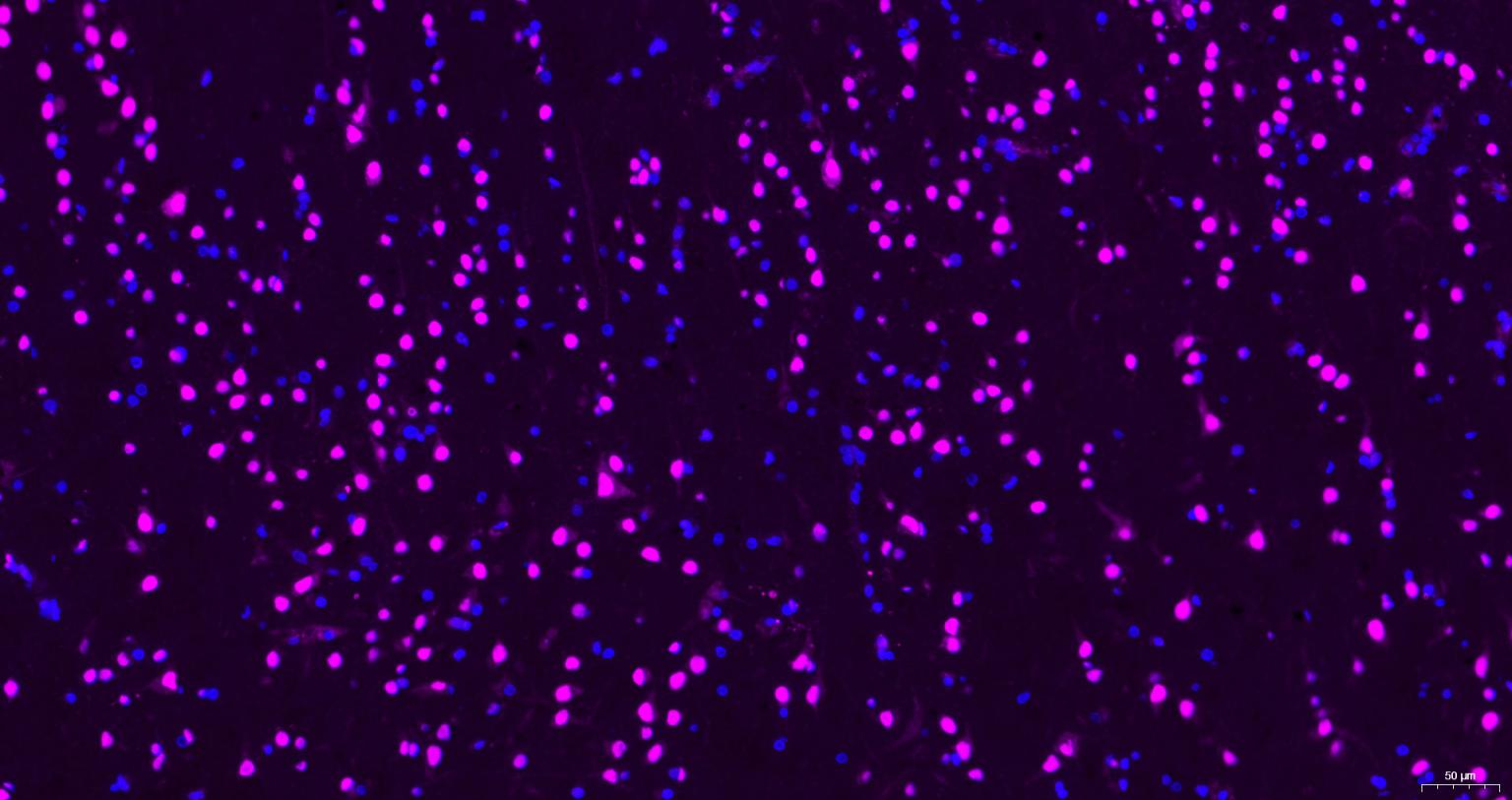 蛋白激酶B重组兔单抗