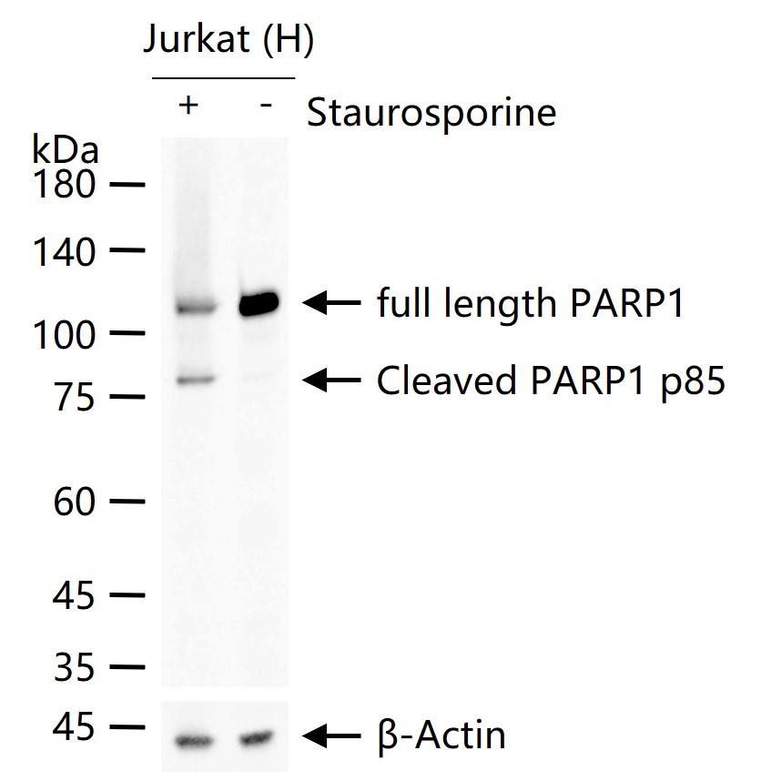 多腺苷二磷酸多聚酶/多聚ADP-核糖聚合酶1重组兔单抗