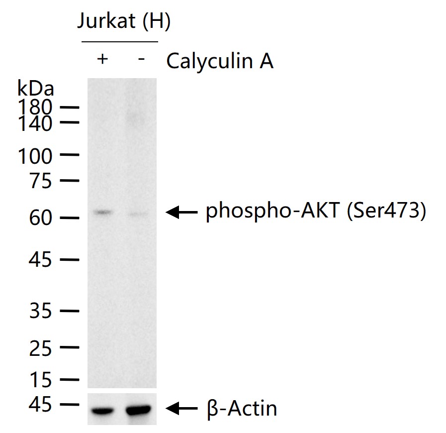 磷酸化蛋白激酶B重组兔单抗