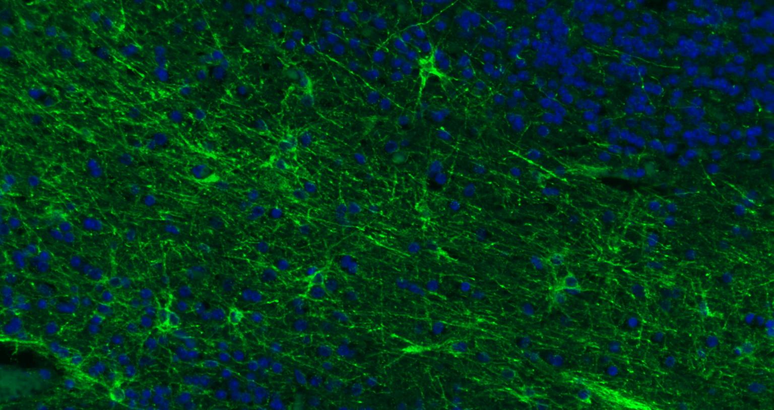 FITC标记的羊抗兔IgG H&L