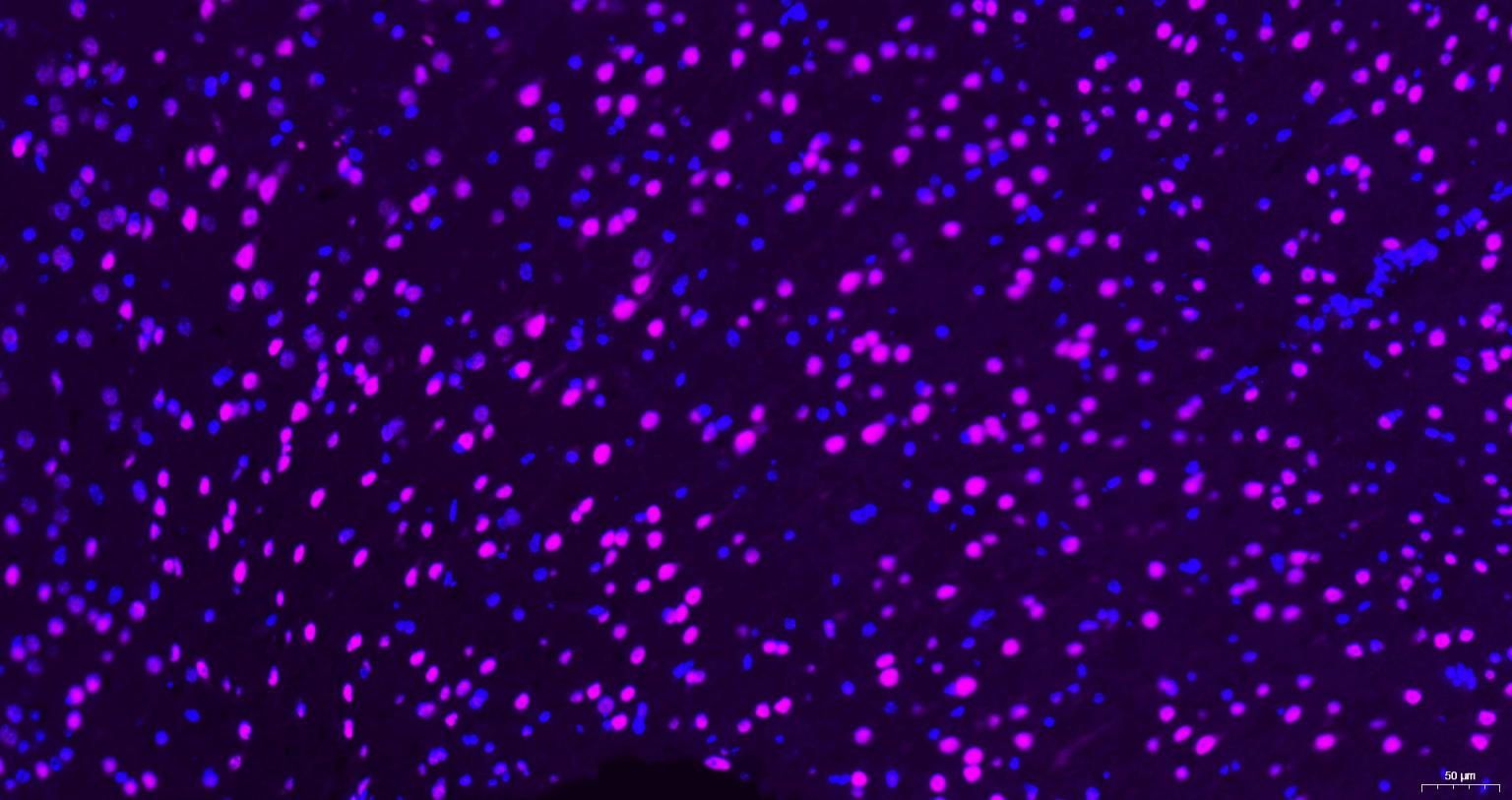 蛋白激酶B重组兔单抗