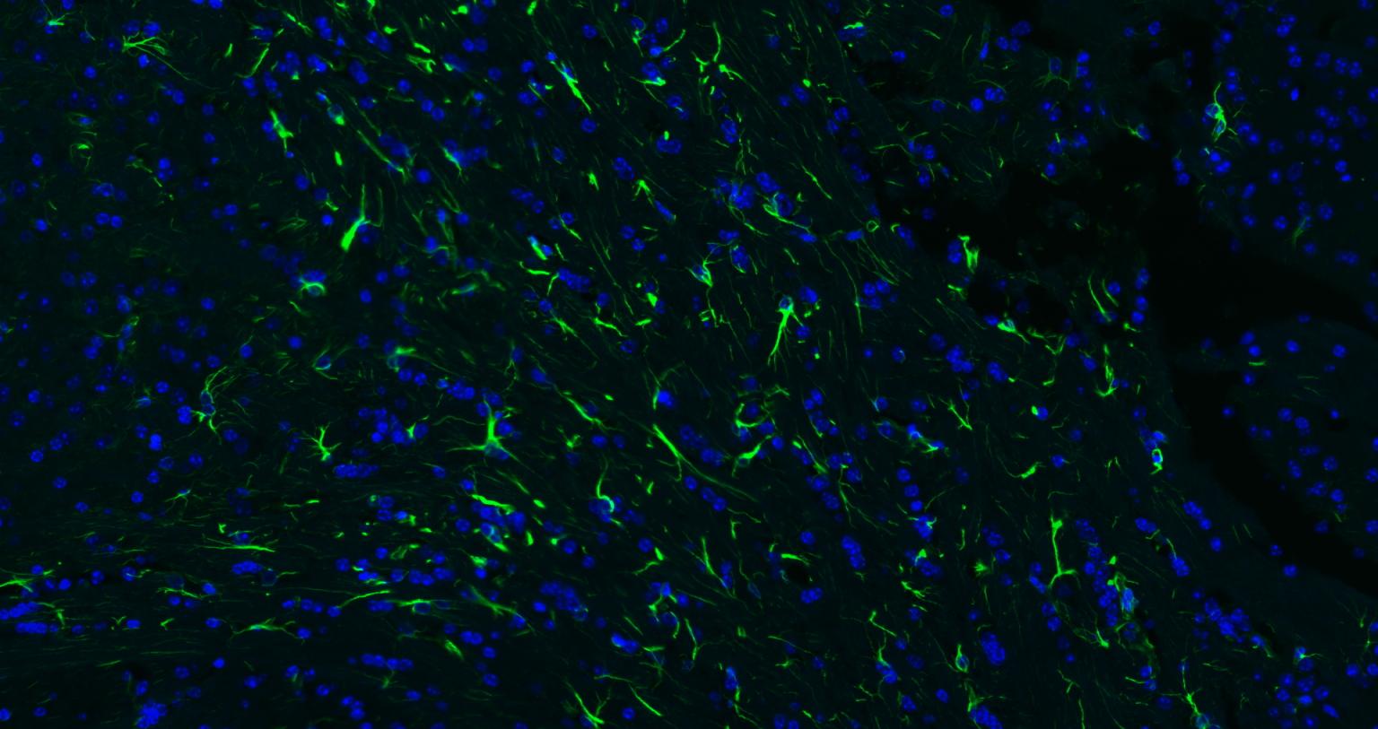 FITC标记的羊抗兔IgG H&L